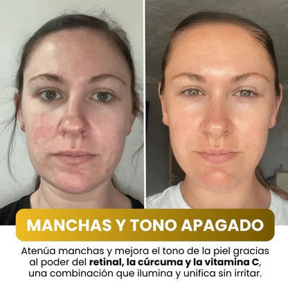 Mascarilla Facial Coreana con Cúrcuma y Colágeno